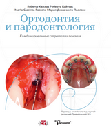 Ортодонтия и пародонтология: Комбинированные стратегии лечения